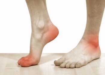 أعراض النقرس في القدم