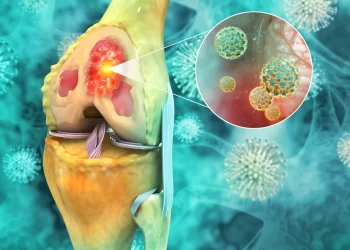 أعراض سرطان العظام