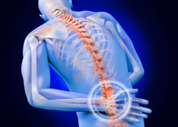 علاج عرق النسا بالأعشاب