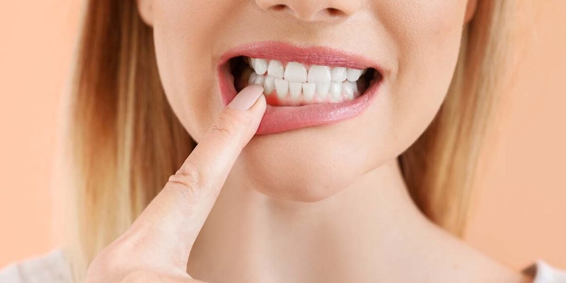 اسباب التهاب اللثة