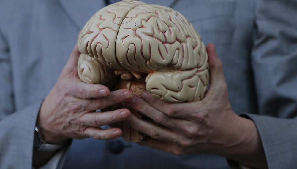 مرض الزهايمر