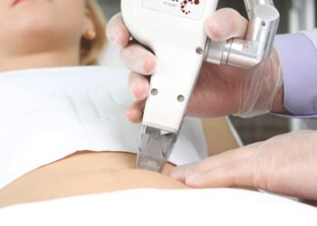 هل الليزر يؤثر على المبايض