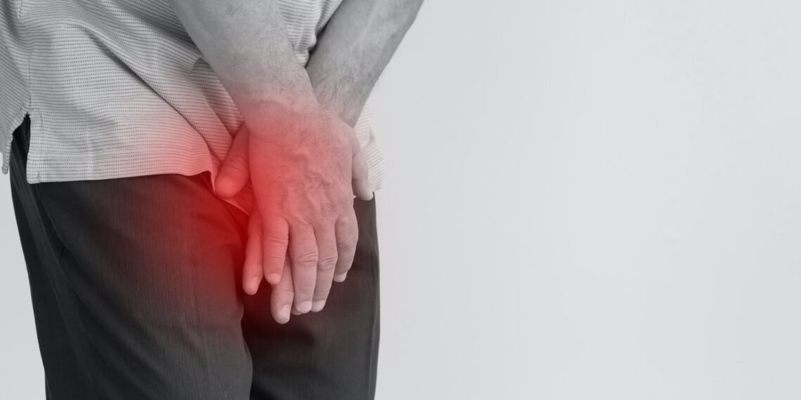 احتقان البروستاتا