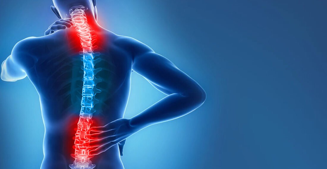 طرق علاج هشاشة العظام